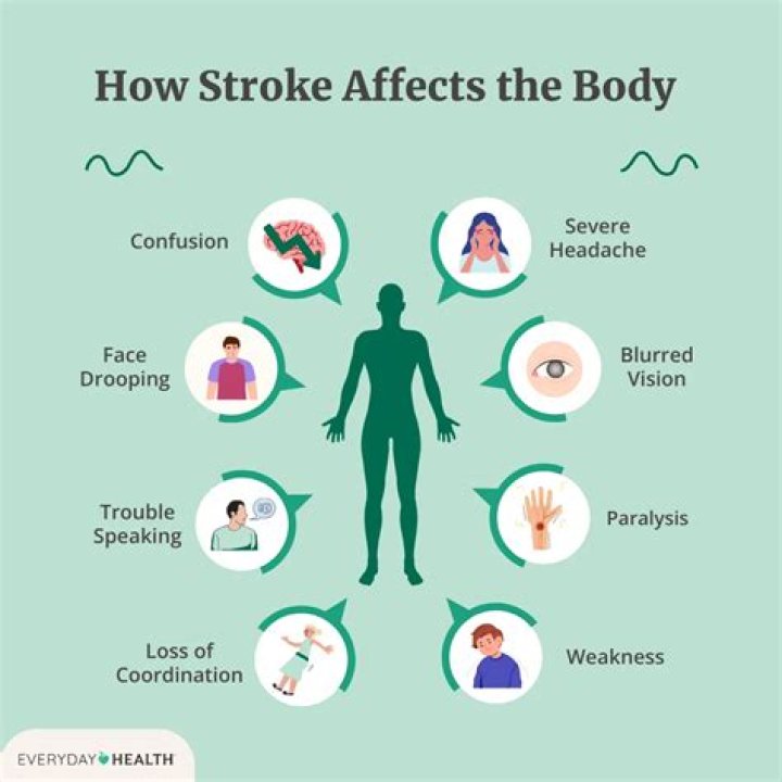 How Stroke's Impact Led To His Untimely Demise