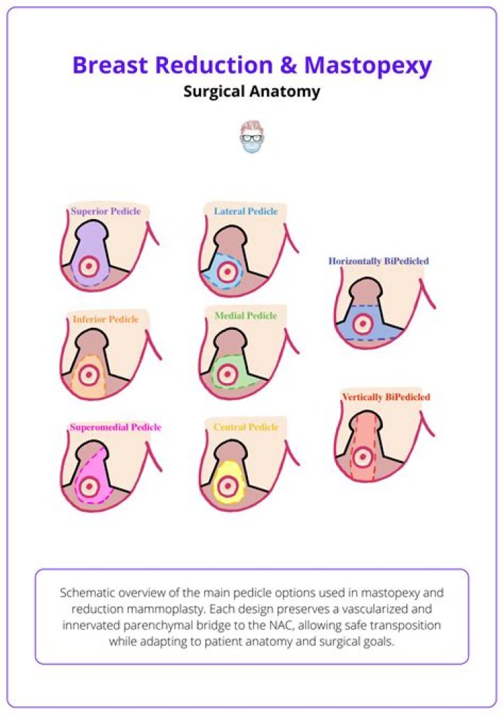 Unraveling The Breast Reduction Enigma