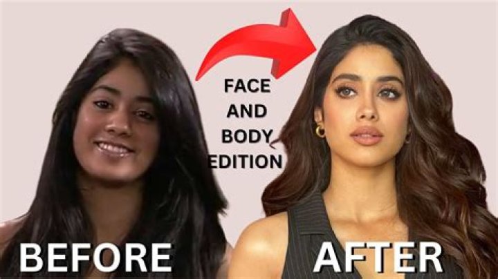Unveiling Janhvi Kapoor's Plastic Surgery Journey: Insights And Revelations